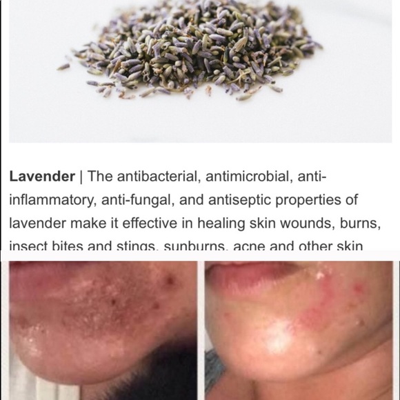 Healing Balm - Picture 7 of 10